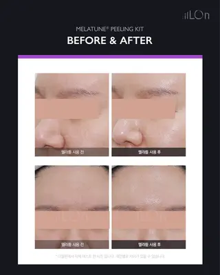 Luca 痩身• 疲労改善×韓国肌管理のエステ・リラクイメージ