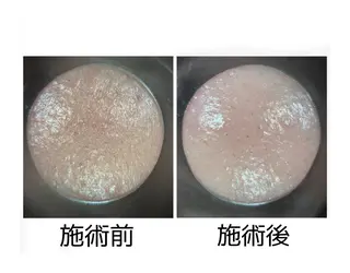 メナード丸の内ヒルズ 柳田りさのエステ・リラクイメージ