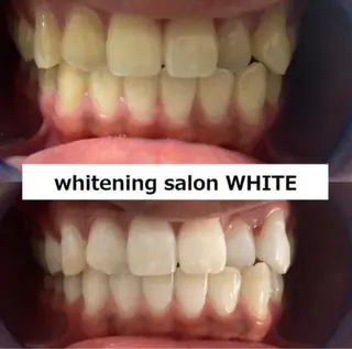 whitening salon WHITE 広島店所属・セルフホワイトニング 専門店WHITE広島のその他イメージ