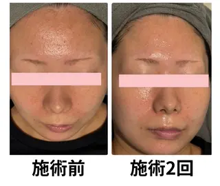 毛穴・ニキビ専門 エステグレースティーのエステ・リラクイメージ