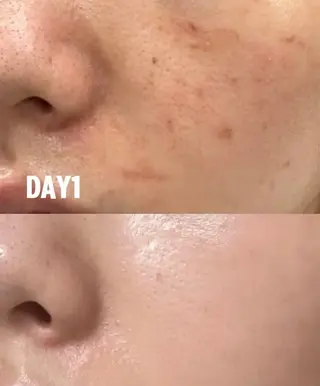 ネイル aliaハーブ水光店 エステティシャン募集のエステ・リラクイメージ