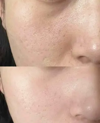 マツエク・マツパ aliaハーブ水光店 エステティシャン募集のエステ・リラクイメージ