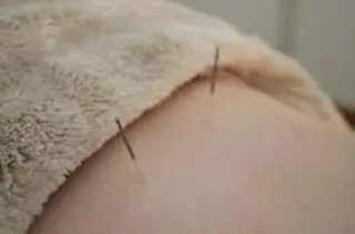 MYCARE 鍼灸&マッサージ代表のエステ・リラクイメージ