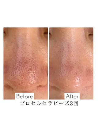 プライベートサロン アオラのネイルデザイン