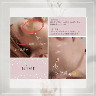 ainoa所属・ainoa アイノアのエステ・リラクイメージ