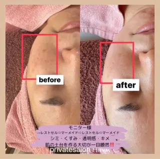 privatesalonHINA所属・小澤 麻美のエステ・リラクイメージ