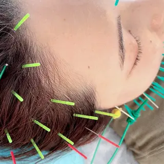 渋谷 小顔美容鍼 専門サロン YZのエステ・リラクイメージ