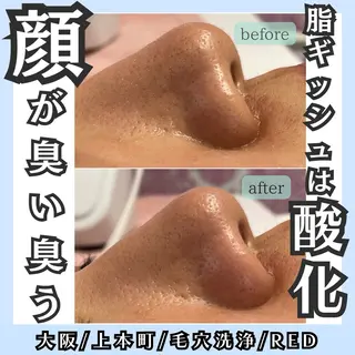 毛穴レス ハーブ& ワックス脱毛×光脱毛のエステ・リラクイメージ