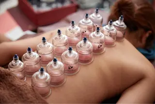 美楽鍼 びらくしんのその他イメージ