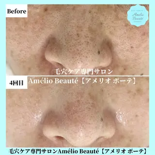 毛穴ケア専門サロン アメリオボーテのその他イメージ