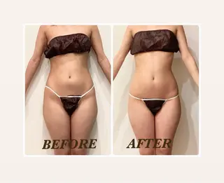 Prima 痩身脱毛 にごうかおりのエステ・リラクイメージ