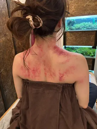 かっさ（刮痧）専門店 心氣院のその他イメージ