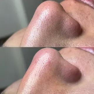 夕希 毛穴と脱毛特化サロンのエステ・リラクイメージ