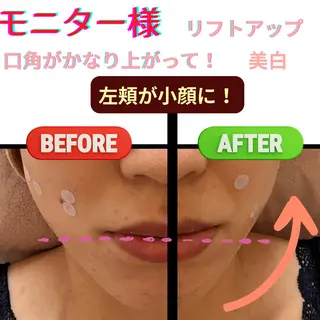 LUMINAルミナ 【肌管理サロン】のその他イメージ