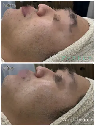 Amily beauty 毛利のエステ・リラクイメージ