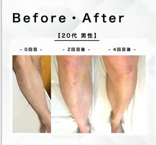 メンズ esthesalon O'-en-のエステ・リラクイメージ