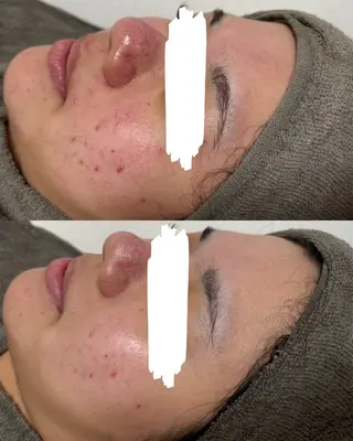 瀧野 史園のエステ・リラクイメージ