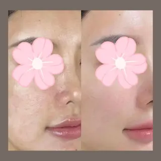 愛維美水光美肌専門店所属・愛維美水光美肌専門店 メンズレディースokのエステ・リラクイメージ