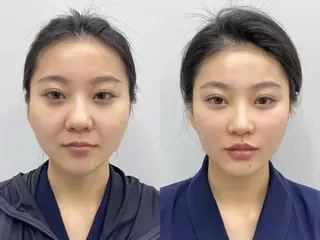 ネイル aliaハーブ水光店 エステティシャン募集のエステ・リラクイメージ