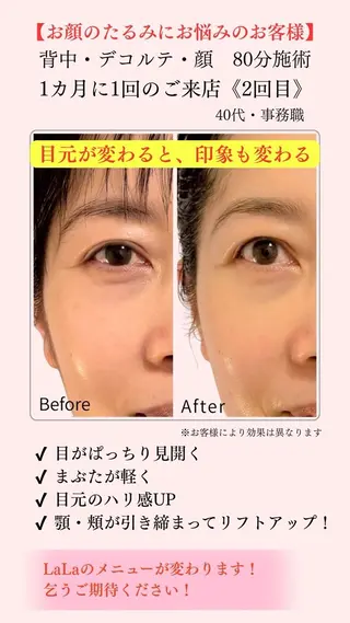 小顔・たるみケア 専門店【LaLa】のエステ・リラクイメージ