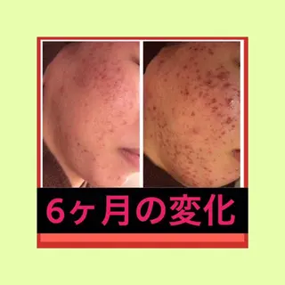 ミディアム カラー パーマ ヘアアレンジ メンズ キッズ ネイル マツエク・マツパ ニキビ・肌質改善専門 ♡人生が変わるサロンのエステ・リラクイメージ