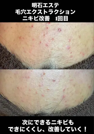 夕希 毛穴と脱毛特化サロンのエステ・リラクイメージ