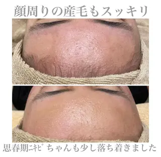 エステサロン Mi-mi.iのエステ・リラクイメージ