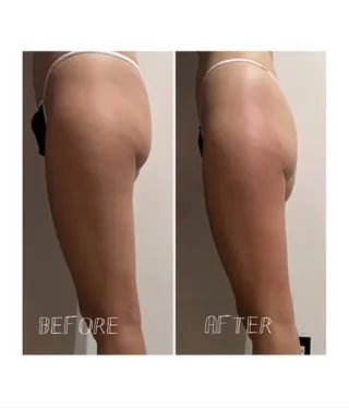 coeur la tusais ゆうきのエステ・リラクイメージ