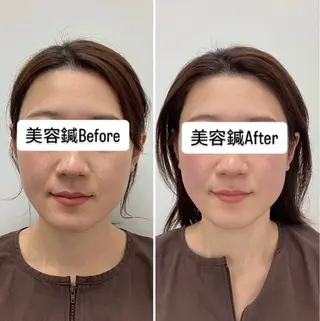 美容鍼灸×小顔整体♡ ハリサロンドオフ堺東のその他イメージ