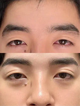 メンズ アイブロウ HBL公式推奨サロン Rieのエステ・リラクイメージ