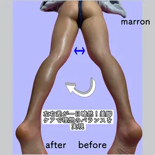 marron所属・痩身ハイパーナイフ ララピールリアボーテのエステ・リラクイメージ