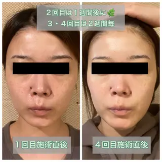 ビューティースタジオ NICO25のその他イメージ