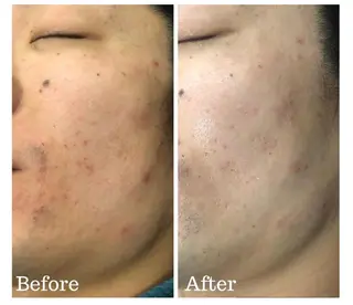 morel モレルのマツエク・マツパデザイン