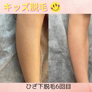 キッズ Pono所属・Pono （ポノ）のエステ・リラクイメージ