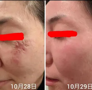 体質・肌質改善サロン アンシャンテのエステ・リラクイメージ