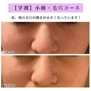Bellesthe (ベルエステ)のエステ・リラクイメージ