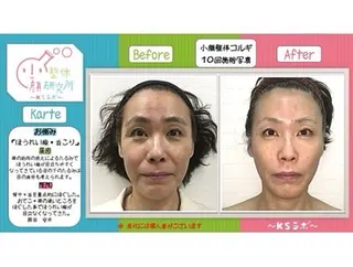 NaKid マツエク&マツパのマツエク・マツパデザイン