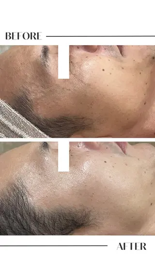 フェイシャル/脱毛 ジョアアンジェ竹田のエステ・リラクイメージ