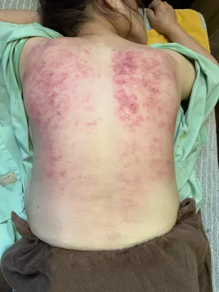 鍼灸院楽々館所属・宇田 碧のエステ・リラクイメージ