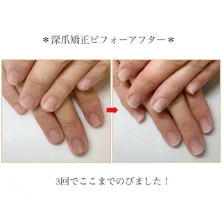 ネイル ネイルサロン アリュームのネイルデザイン