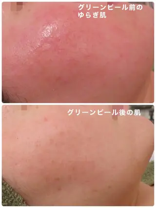 鈴木 さくらのエステ・リラクイメージ