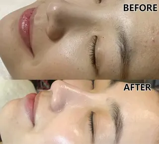 愛維美水光美肌専門店所属・愛維美水光美肌専門店 メンズレディースokのエステ・リラクイメージ