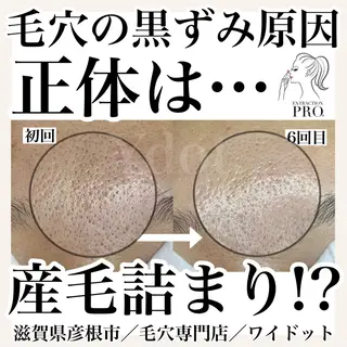 Ydot. 池内 友架のエステ・リラクイメージ