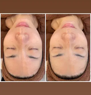 パーソナルスキンケア 🦋APRI🅿️有のエステ・リラクイメージ