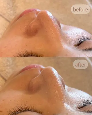 MiEL total beauty salon所属・Rie ×MiELのエステ・リラクイメージ