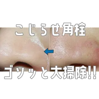 Sugaring / HILOT TAOのエステ・リラクイメージ