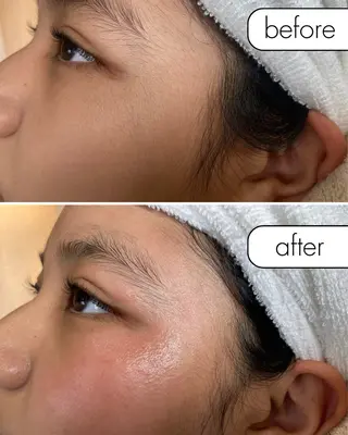 蝶式糸除毛専門salon aco所属・糸除毛専門salon acoのエステ・リラクイメージ