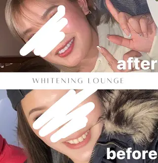 ホワイトニング Lounge横須賀のエステ・リラクイメージ