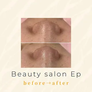 メンズ beauty salon epのエステ・リラクイメージ