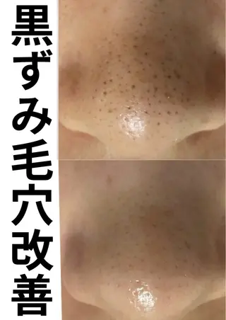 beauty salonN.11のエステ・リラクイメージ